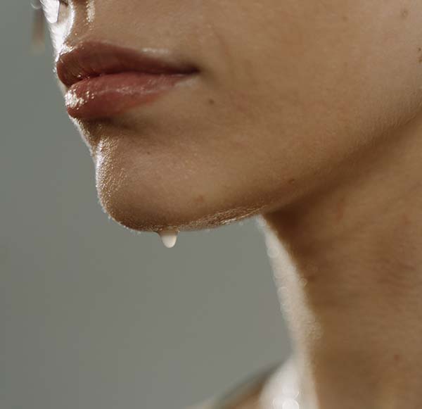 Hiperhidrosis facial o craneofacial cirugía